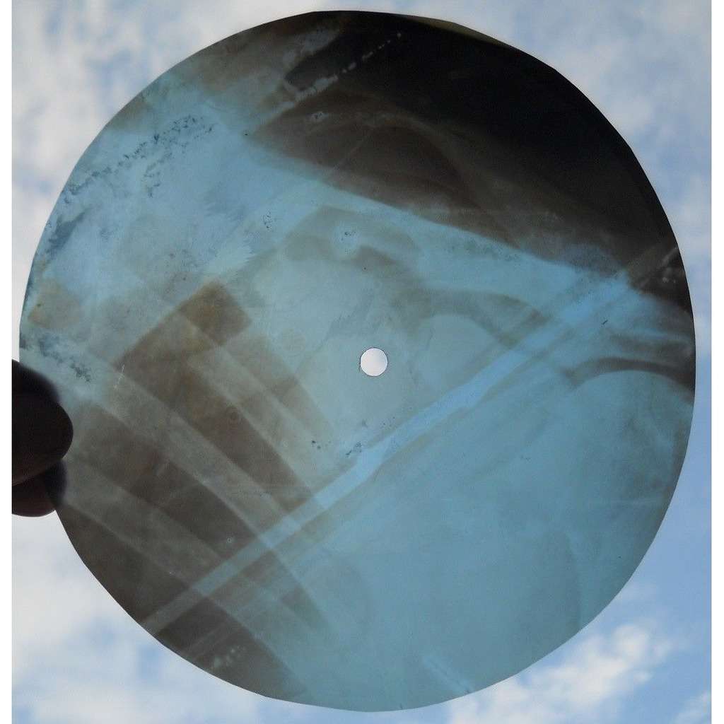 Mother song xray roentgen bones ribs record by Qsovreli Brothers