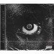 damso lithopédion