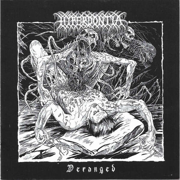  Hyperdontia (2)  -  deranged 