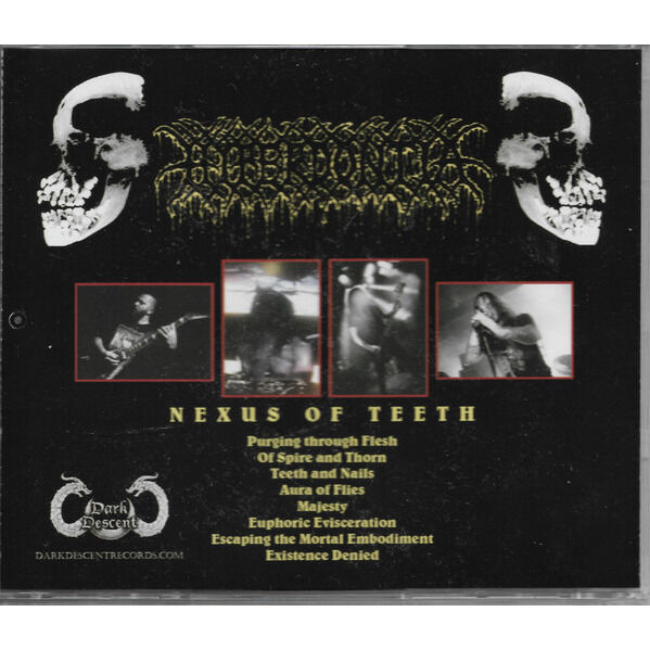  Hyperdontia (2)  -  nexus of teeth 